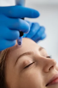 Skin Serenity Microneedling