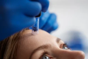 Microneedling in NYC - Skin Serenity